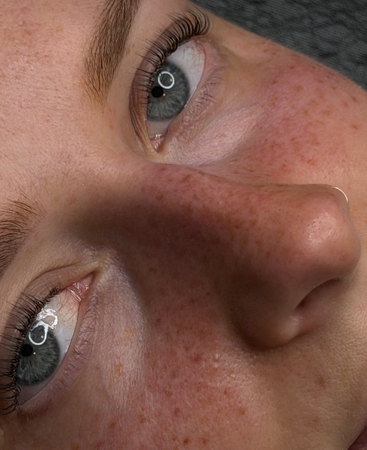 Natürlich wirkende Freckles